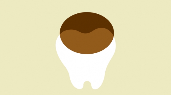 مصرف قهوه و سلامت دندان