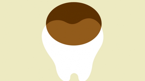 Coffee consumption and dental health