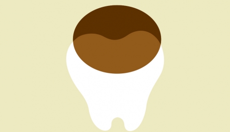 Coffee consumption and dental health